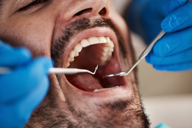 Best Emergency Broken Tooth Repair in Short Pump, VA