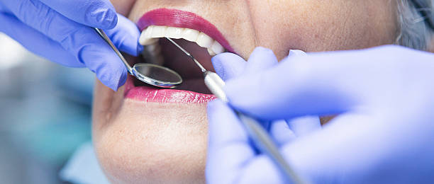 Best Emergency Wisdom Teeth Removal in Short Pump, VA