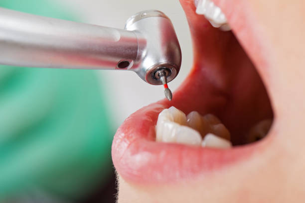 Best Same-Day Emergency Dentist in Short Pump, VA